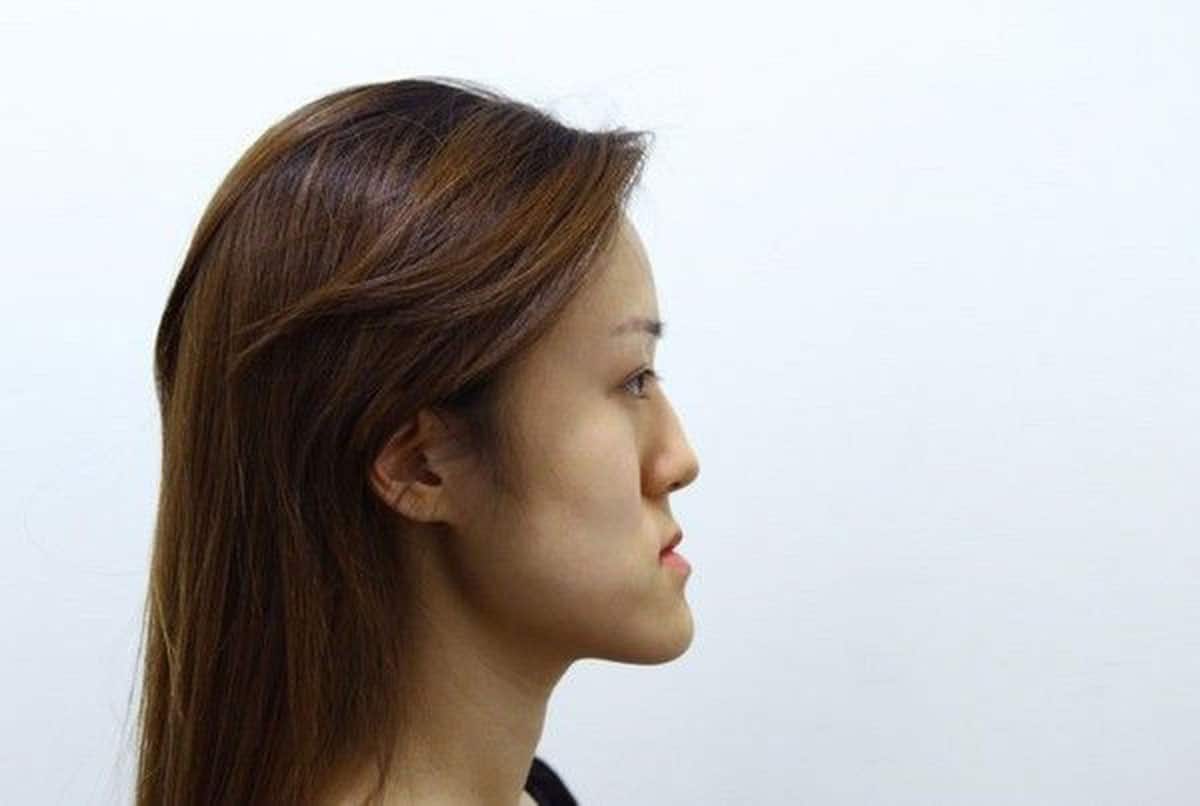 xem tuong mat luoi cay moi neo gian nan hoi vi sao